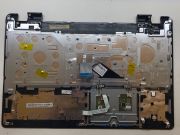 Acer Aspire SİYAH E5-571 E5-571G E5-551 E5-521 E5-511 E5-531 Üst Kasa