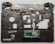 Grundig 1XLGB14 Üst Kasa