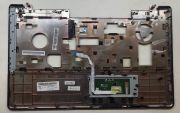 Grundig Nblb 5 Nblb5 Üst Kasa