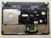 Grundig Gnb 1555 11K812-01 Üst Kasa