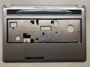 Grundig Gnb 1555 11K812-01 Üst Kasa