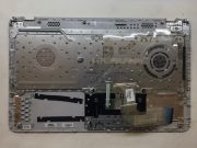 Hp 15-p 15-p251nt 15-p102nt 15-p256nz Üst Kasa